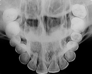 Radiografias intraorais