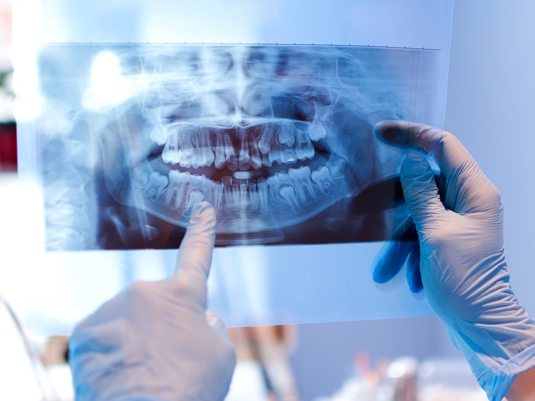 Radiografias panorâmicas (ortopantomografia)