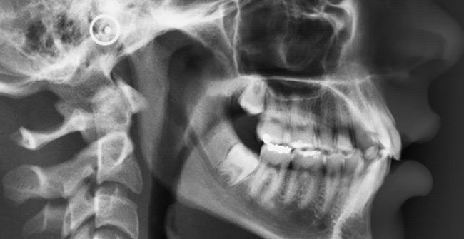 Telerradiografias (perfil e frontal)