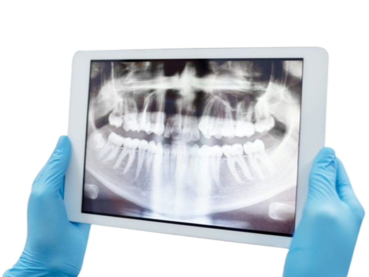 Radiologia Dentária