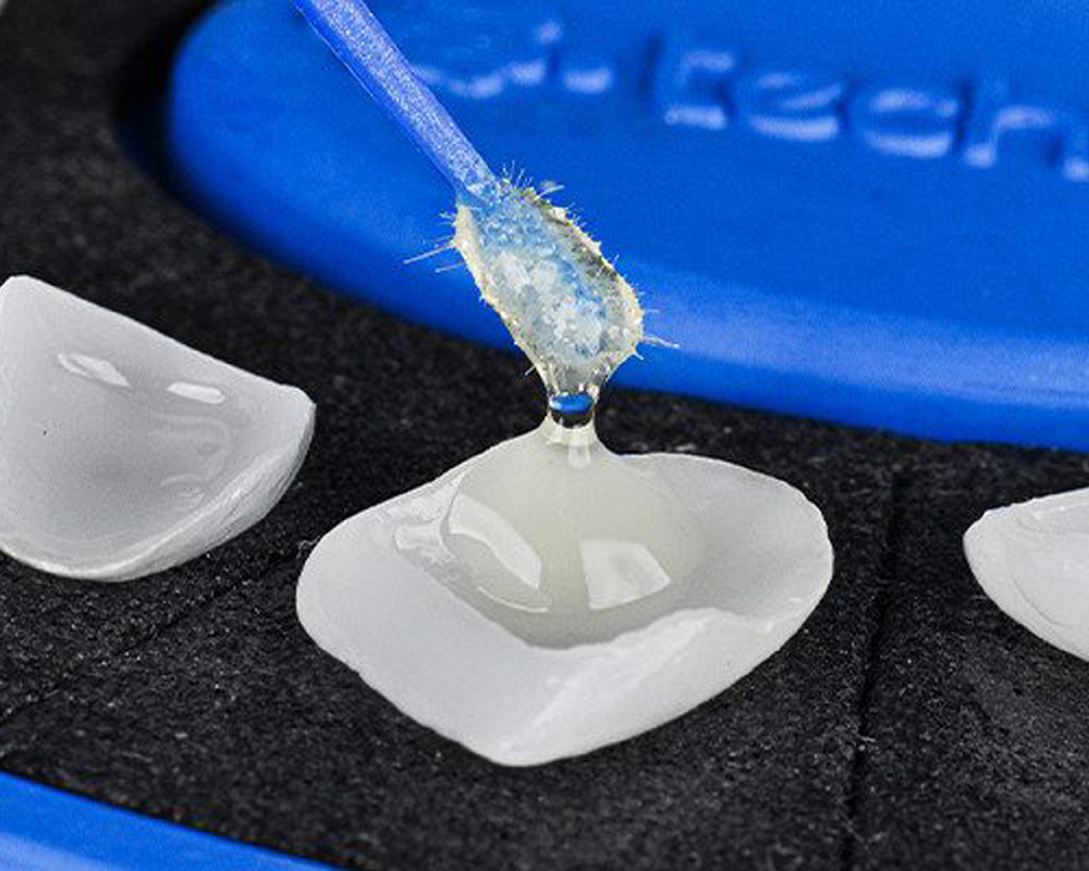 Facetas em cerâmica