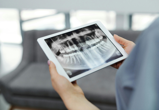 Radiologia Dentária